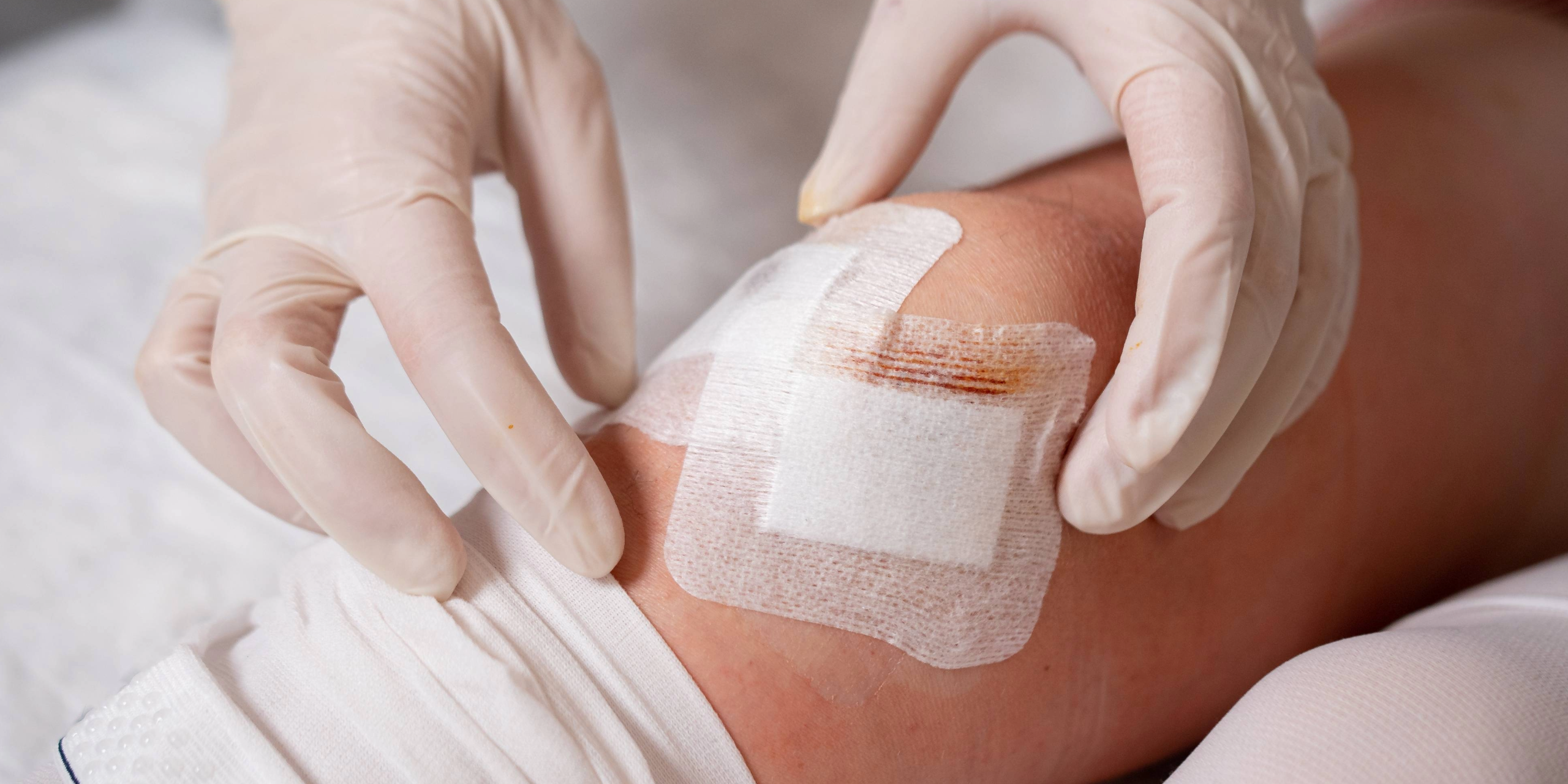 Bandages for open wounds discount